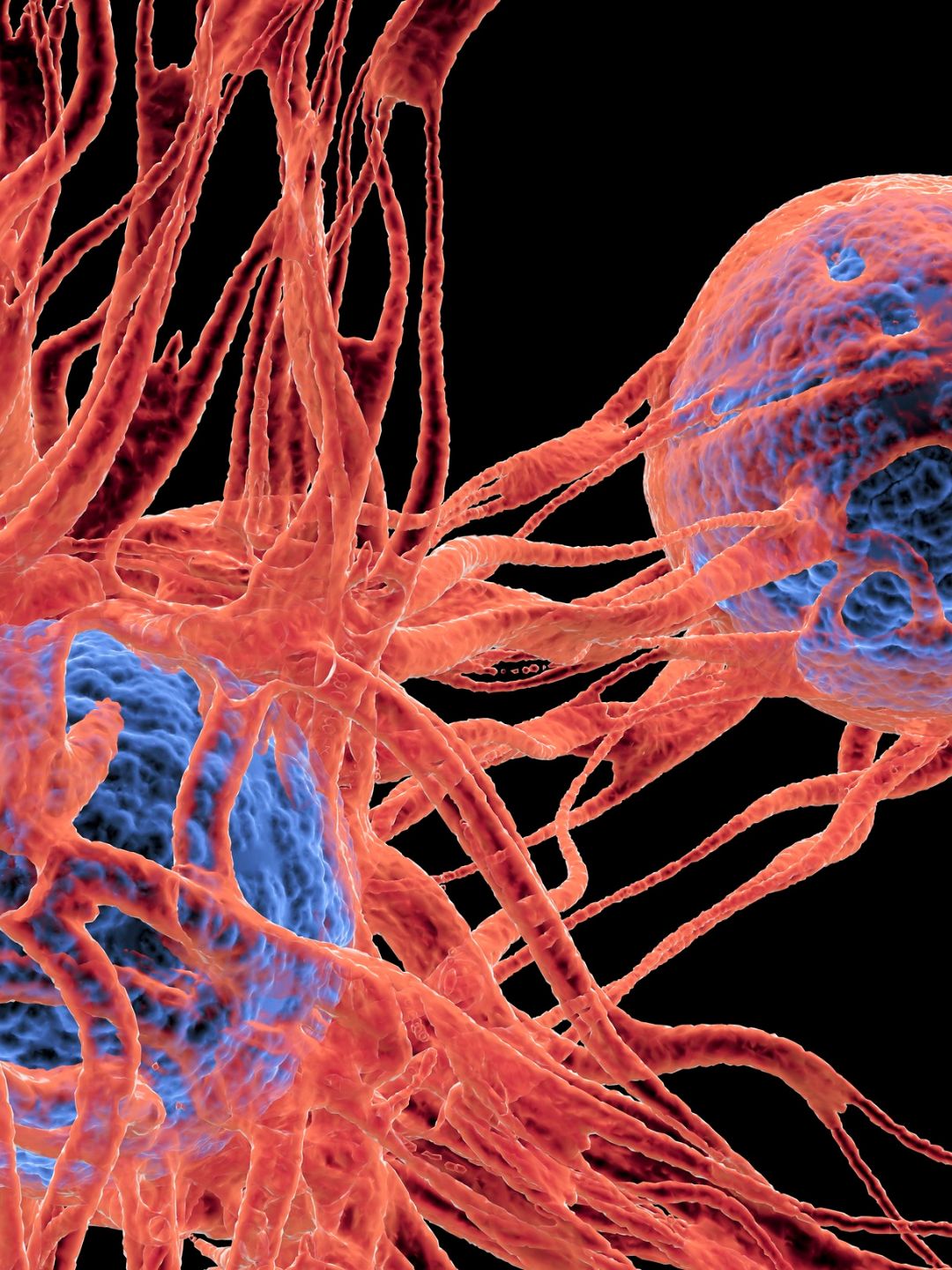 cellules cancéreuses